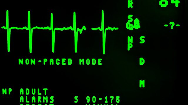 心拍ゾーン 心拍数 の表記方法と運動強度 2b Runner